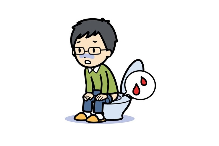 切れ痔の初期症状と代表的な症状